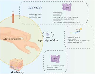 Potential biomarkers of atopic dermatitis